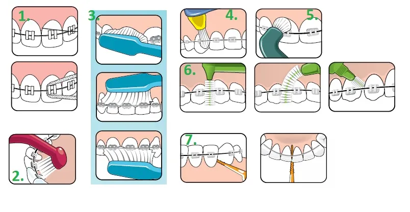 higiena jamy ustnej aparat ortodontyczny