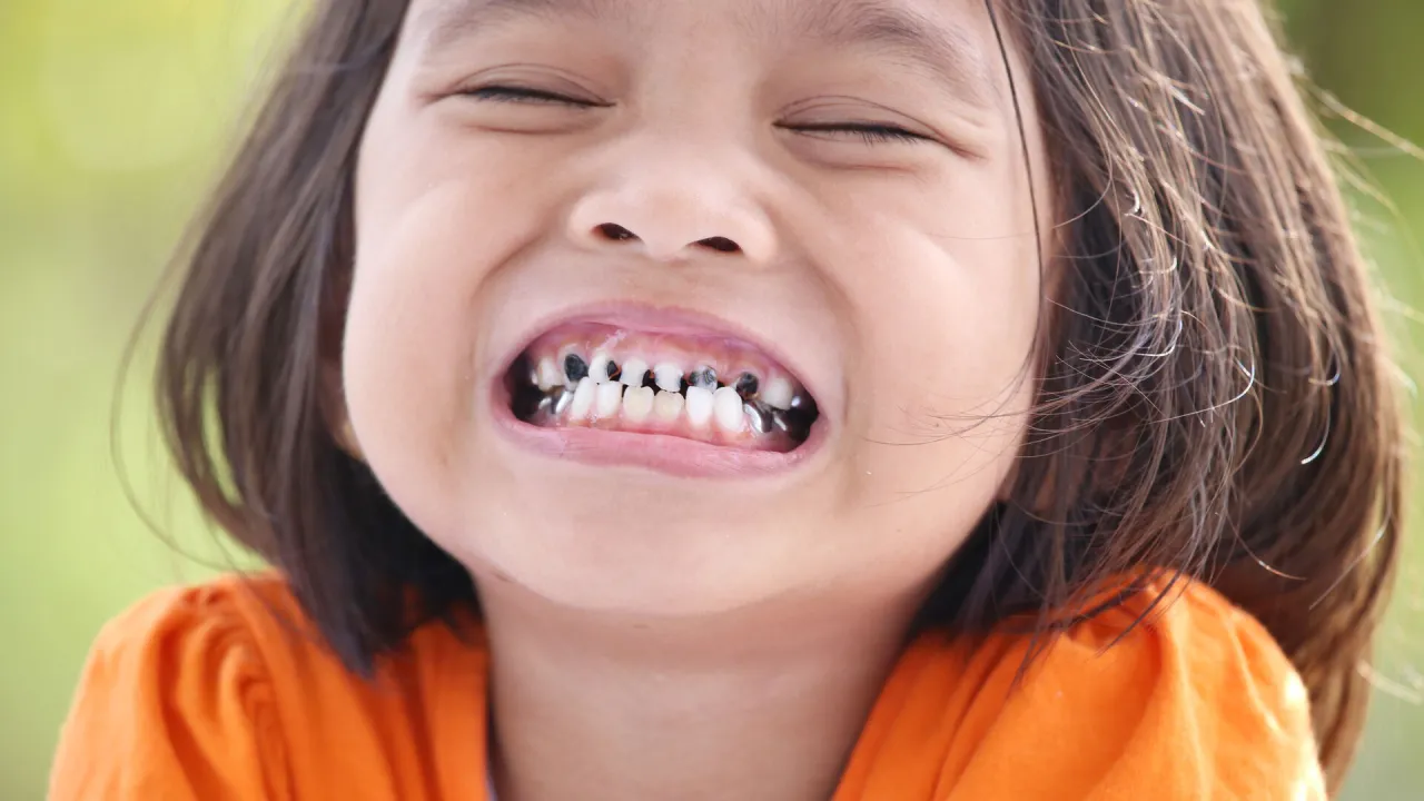 dziecko pełne uzębienie mleczne
