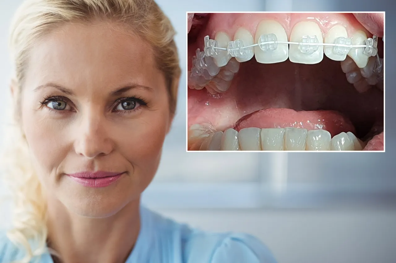 dorosły pacjent z aparatem ortodontycznym