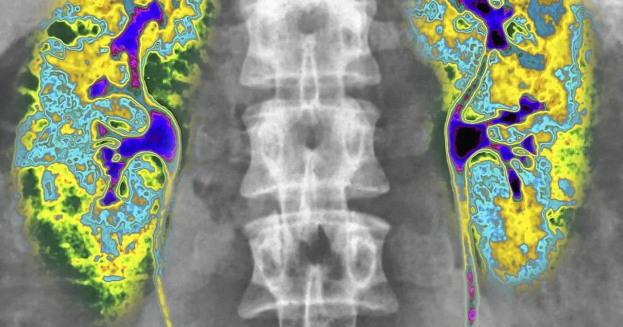 Scyntygrafia kości zasada działania