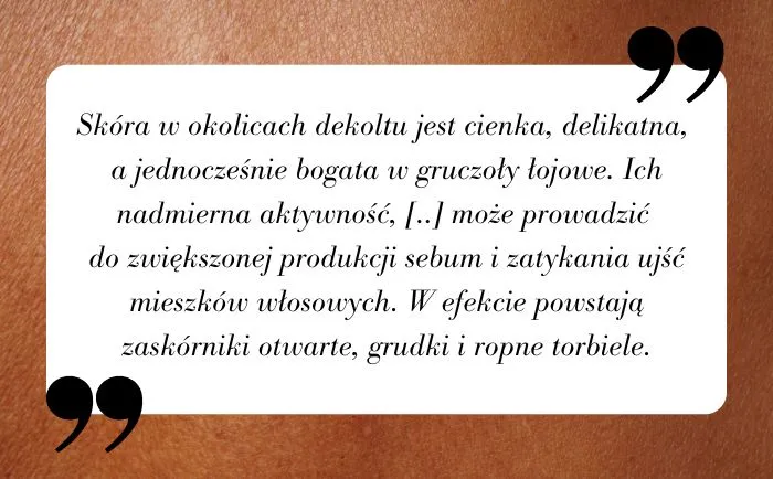 pielęgnacja dekoltu profilaktyka trądziku