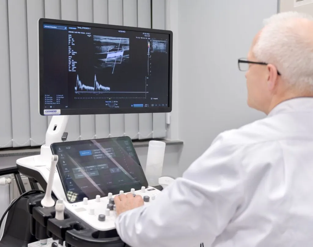 USG Doppler kończyny górnej