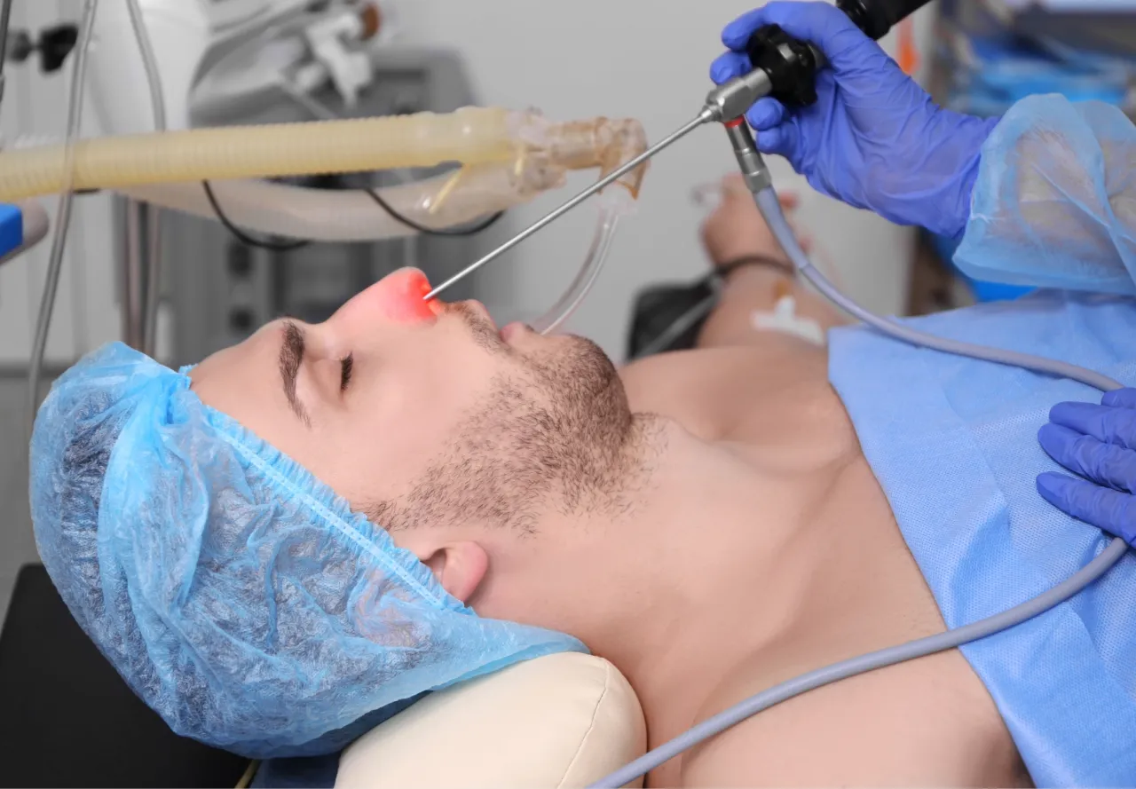 Endoskopowa operacja zatok FESS schemat