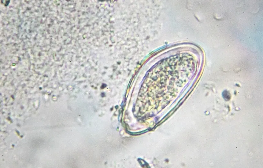 r&oacute;żne rodzaje pasożyt&oacute;w w kale mikroskop