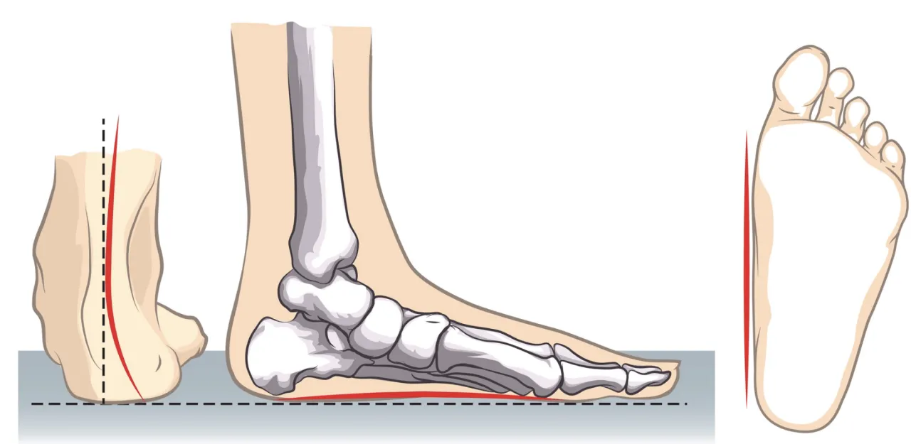 budowa stopy dziecka anatomia