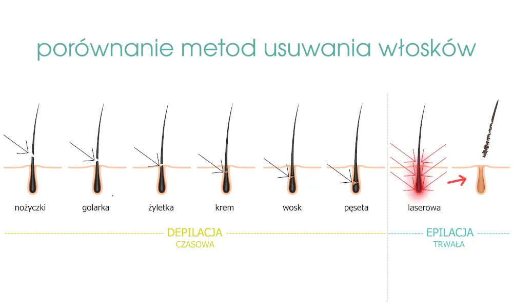 Porównanie bólu depilacji laserowej, woskiem i depilatorem