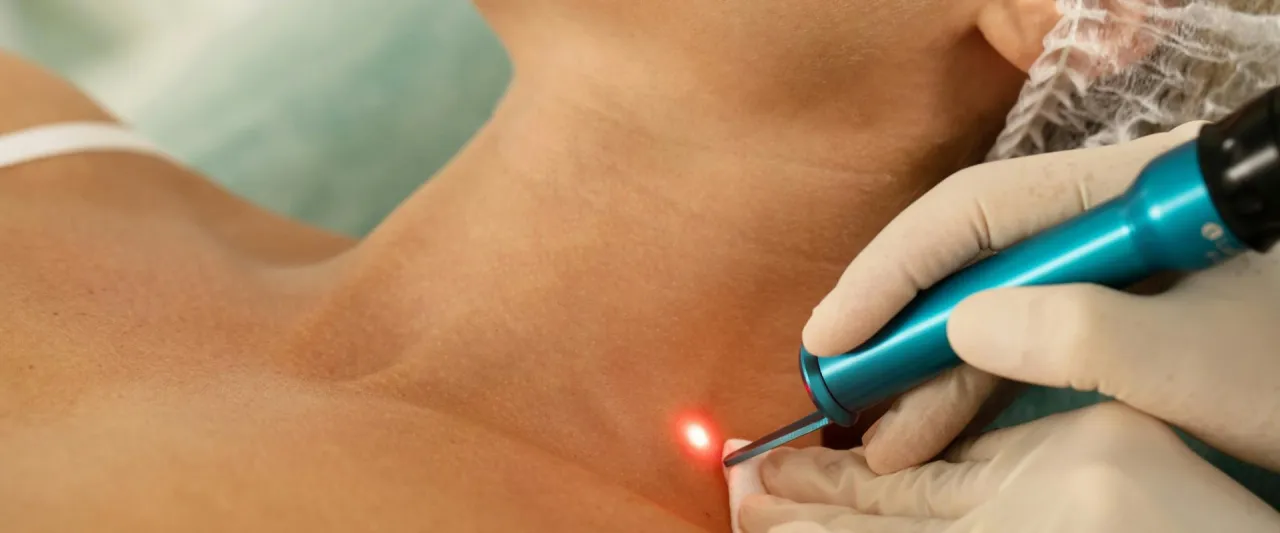 Kosmetyki regenerujące po laserze frakcyjnym