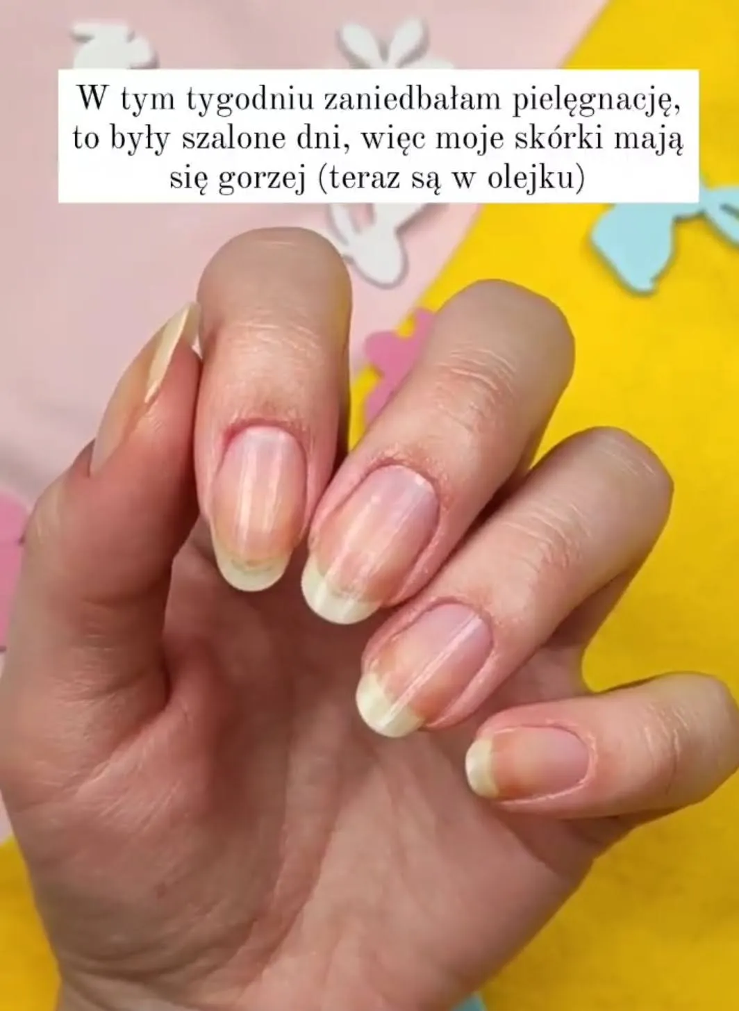 Zdjęcie Jak szybko zapuścić paznokcie? Skuteczne metody na piękne dłonie
