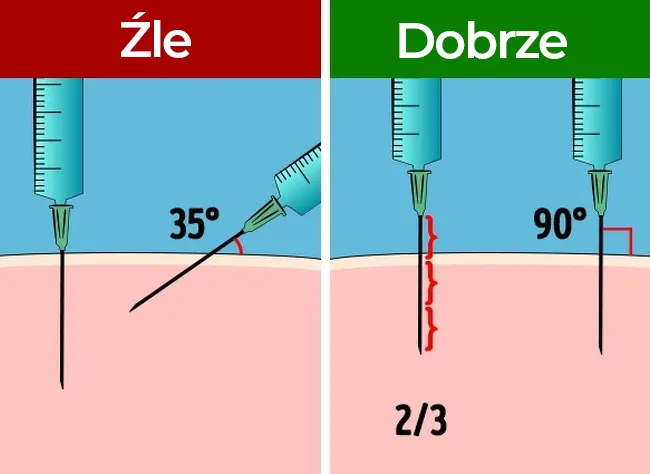 Zdjęcie Jak bezboleśnie wykonać zastrzyk podskórny w ramię? Nasze metody