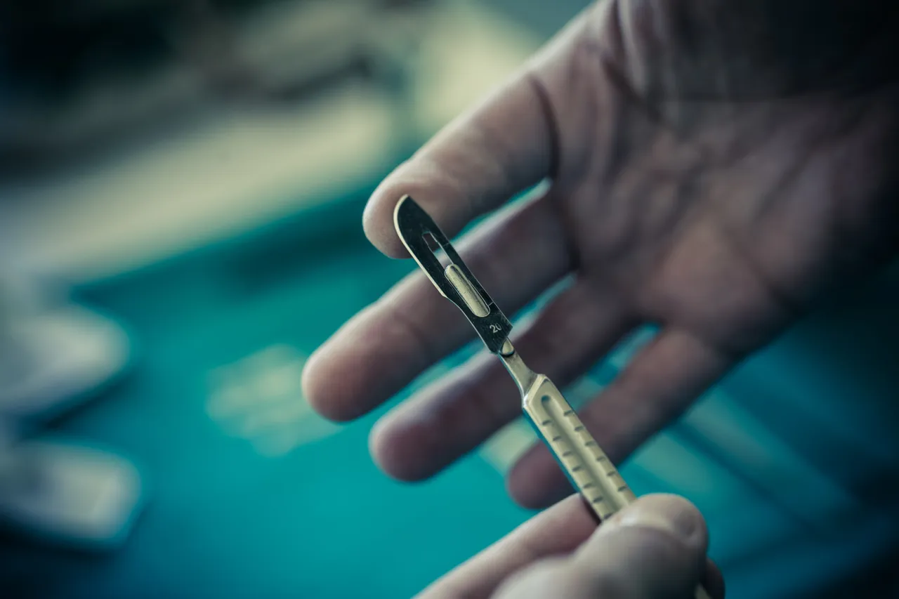 Dłoń trzyma skalpel. Wyniki sekcji zwłok dla rodziny są omawiane.