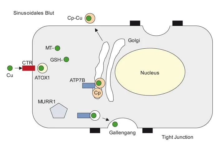 Morbus Wilson Diagnostik Laborwerte &Uuml;bersicht