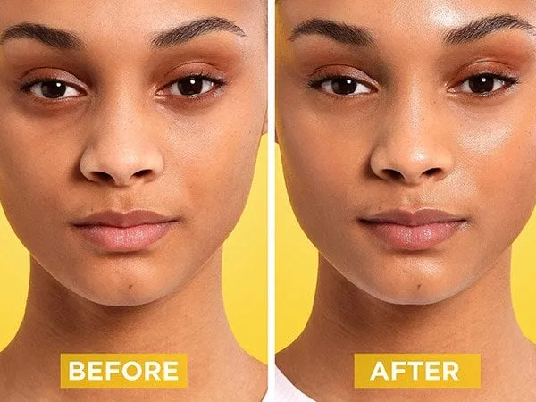 Vitamin C Hautpflege Vorher Nachher