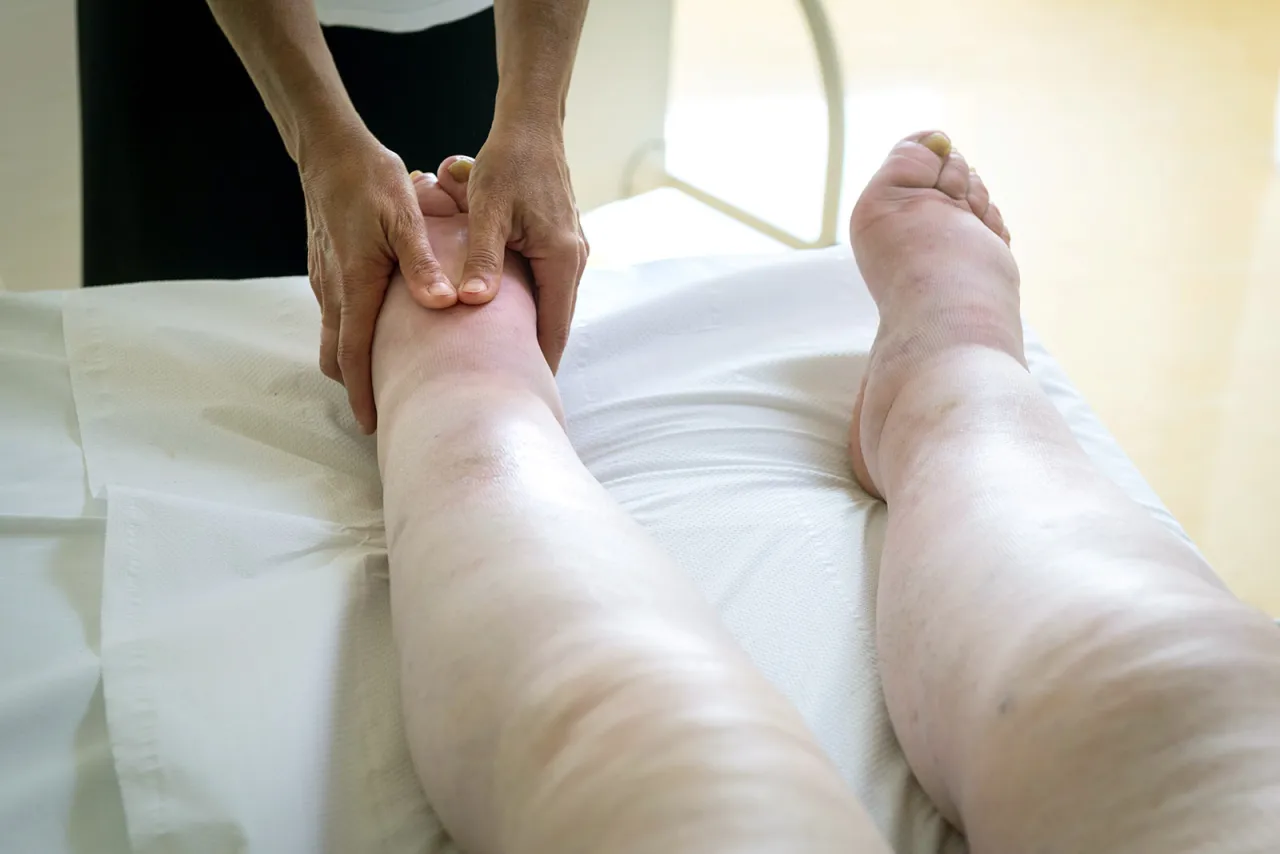 Opuchnięte nogi i układ limfatyczny