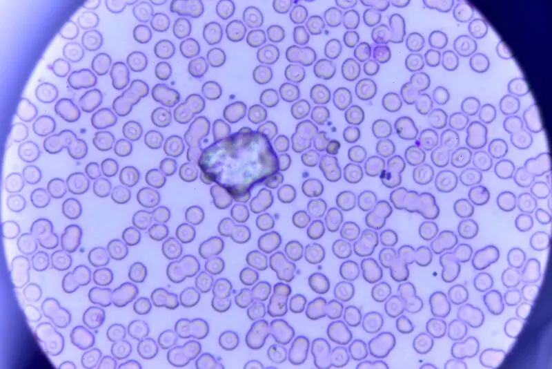 wyniki morfologii krwi, erytrocyty pod mikroskopem
