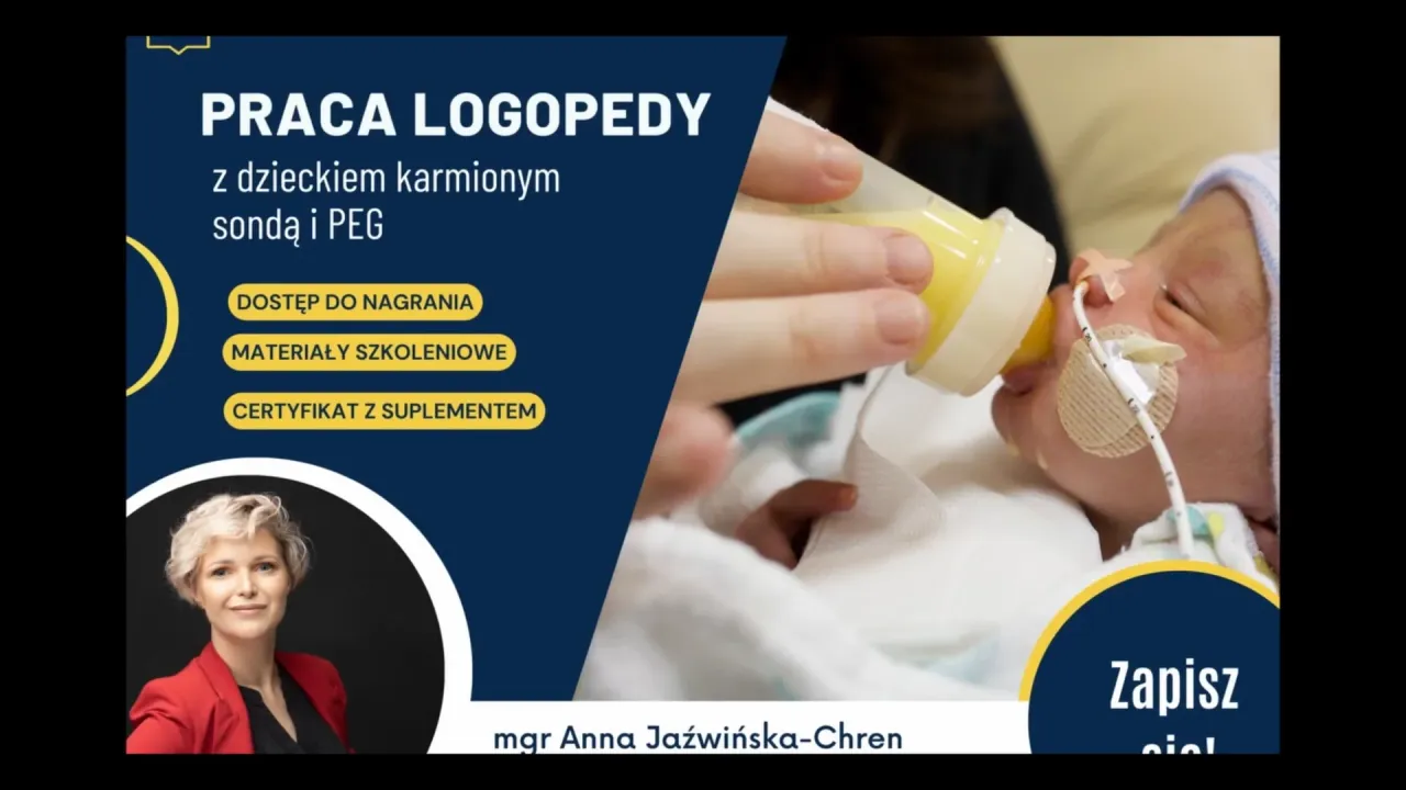 Rodzaje dostępu dojelitowego zgłębnik nosowo-żołądkowy PEG