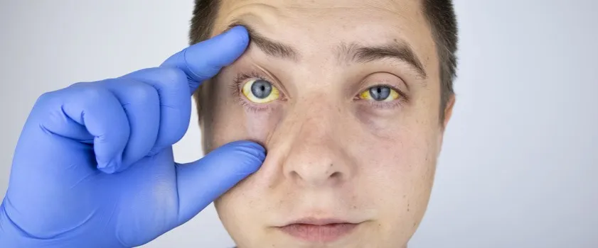 Zdrowy styl życia zespół Gilberta