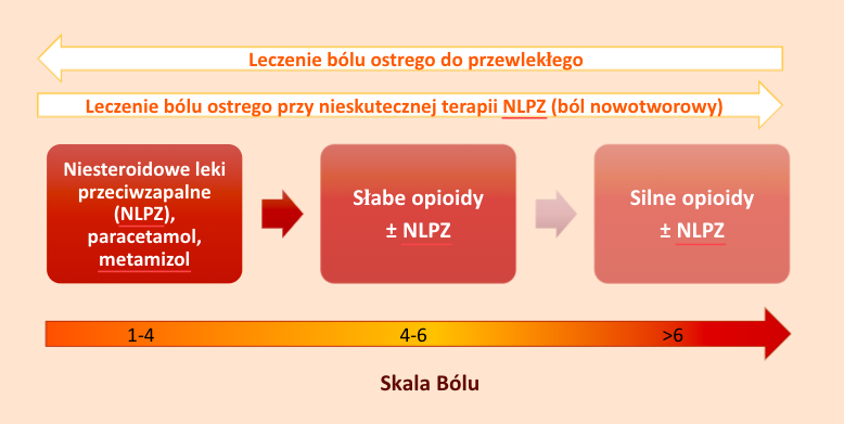 Diagram wyboru leku na ból głowy