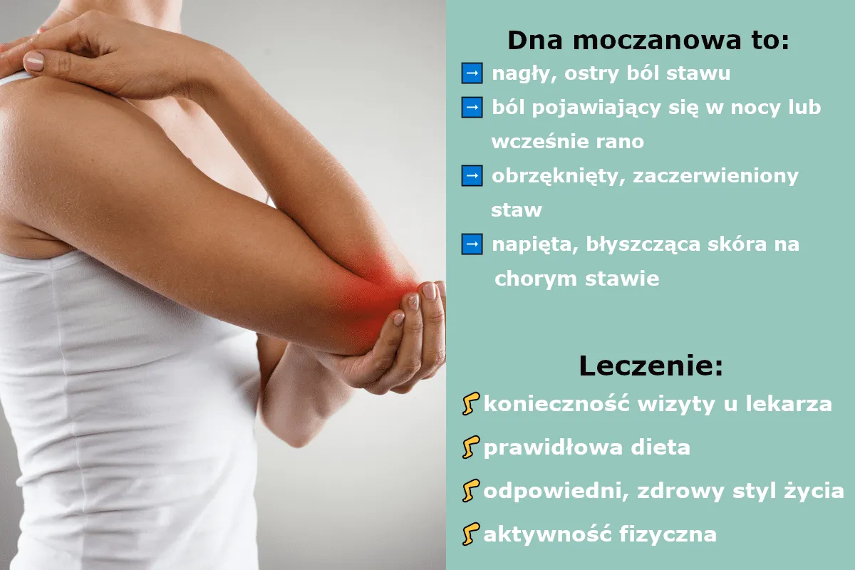 Bolesny atak dny moczanowej