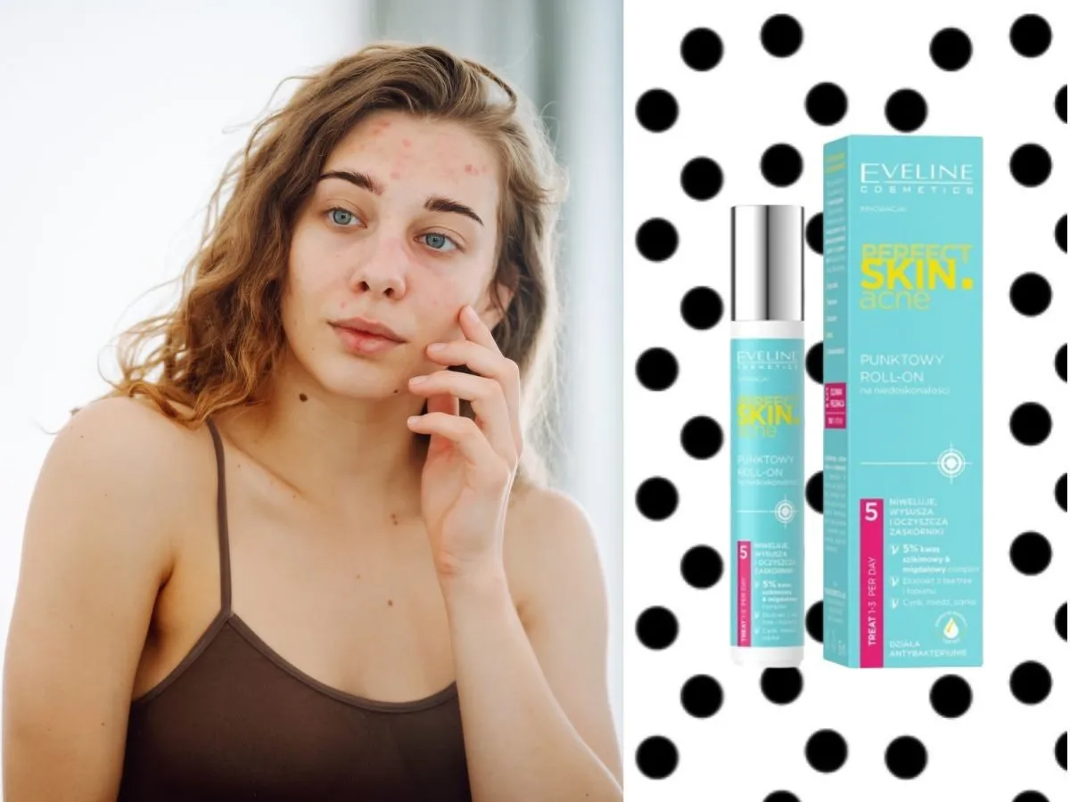 różne formy preparatów na pryszcze punktowe