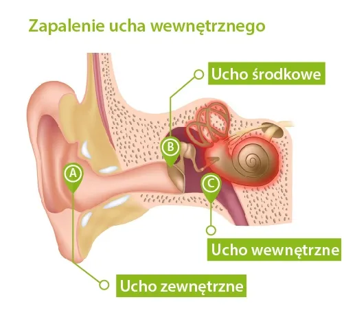 objawy zaburzeń błędnika infografika