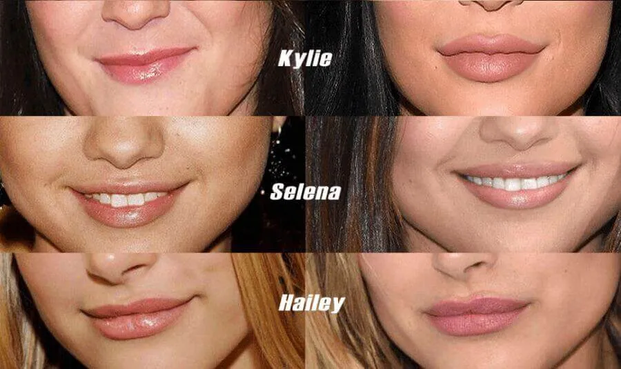 naturalne metody powiększania ust przed i po