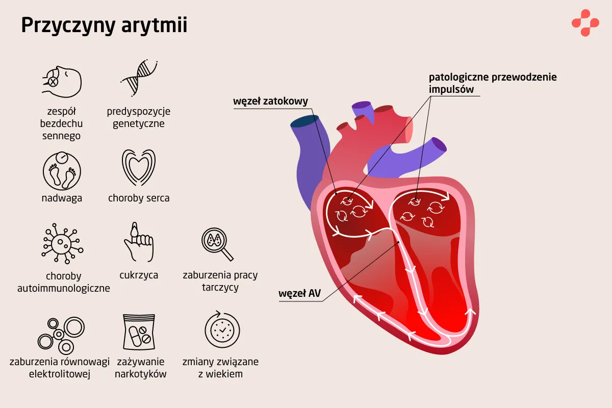 infografika objawy zaburzeń przewodzenia serca