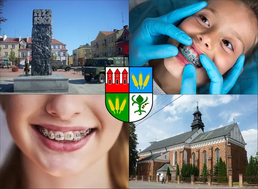 Cennik aparat&oacute;w ortodontycznych 2026