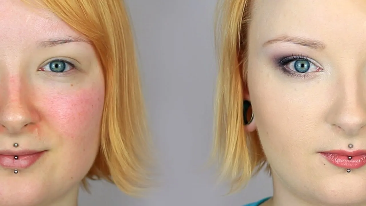 zielony korektor przed i po, cera trądzikowa, popękane naczynka