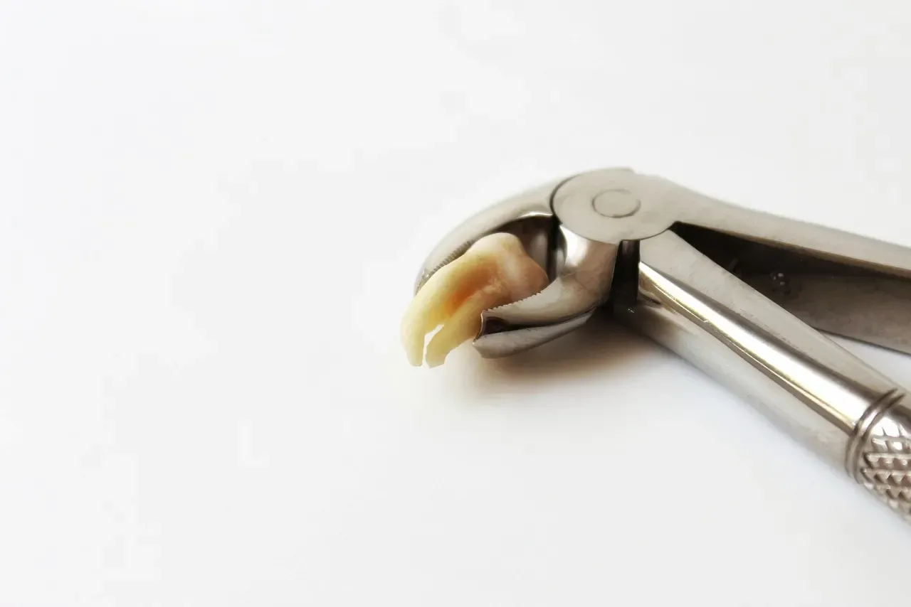 ryzyko samodzielnego wyrywania zęba stałego