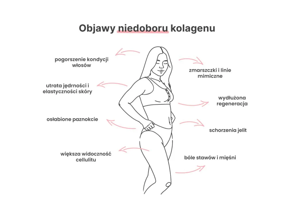 objawy niedoboru kolagenu sk&oacute;ra stawy