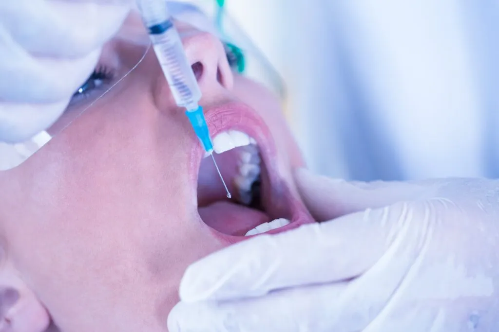 Zdjęcie Jak wygląda znieczulenie u dentysty? Oczekuj bezbolesnych zabiegów
