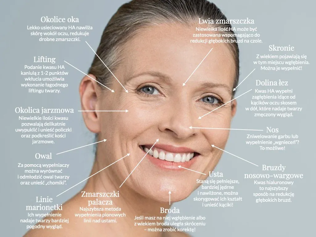 Bezpieczeństwo kwasu hialuronowego w kosmetykach i medycynie estetycznej