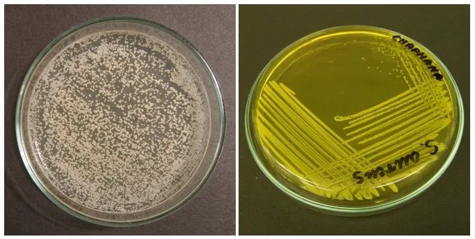 Zdjęcie Enterococcus faecalis w nasieniu: Jak leczyć tę bakterię?