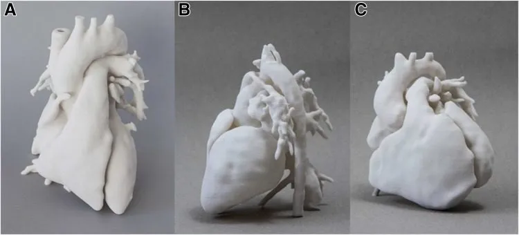 Przykłady wydruk&oacute;w 3D w medycynie
