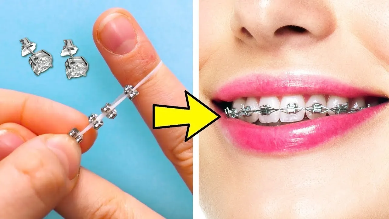 Materiały do sztucznego aparatu na zęby DIY