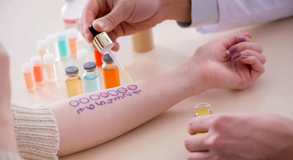 testy alergiczne na mleko