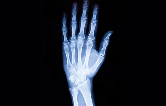 diagnostyka skręcenia nadgarstka RTG USG