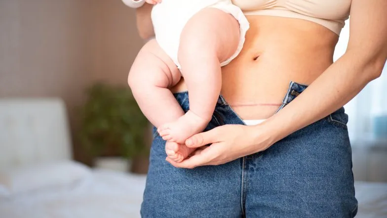 Zdjęcie Kiedy do fizjoterapeuty po cc? Kluczowe wskazówki dla mam