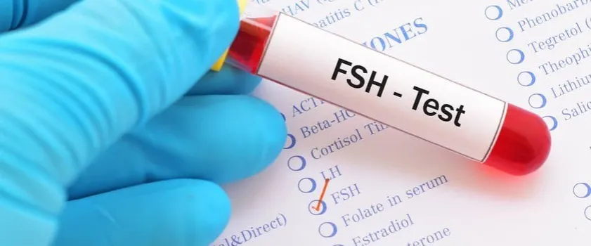 Zdjęcie Kiedy badać FSH, aby uzyskać dokładne wyniki i poprawić płodność