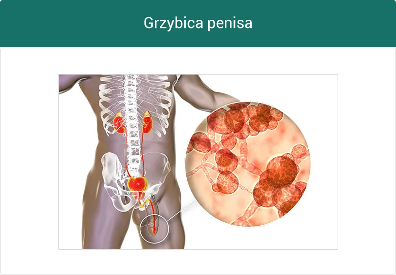 Zdjęcie Niepokojące objawy chorób kobiecych narządów płciowych – kiedy udać się do lekarza?
