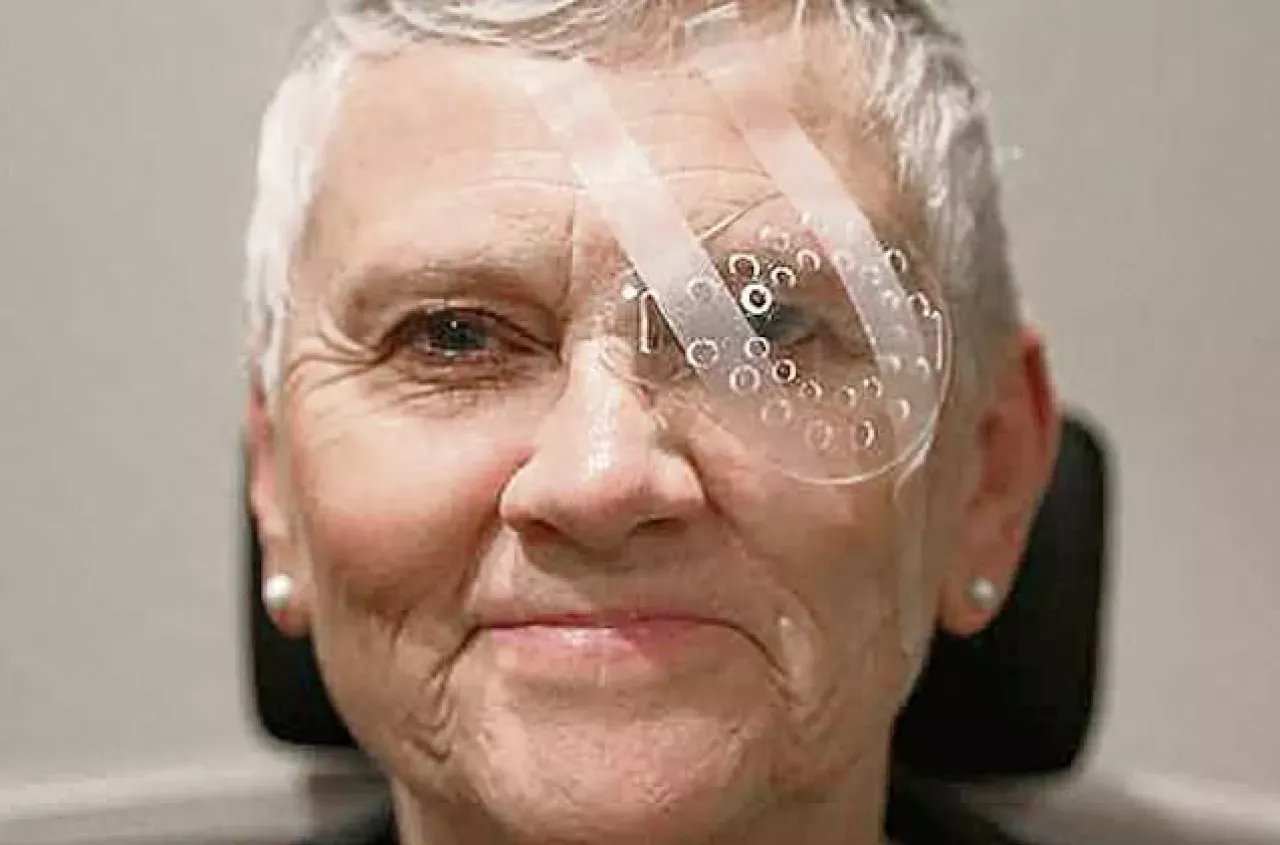 oko po operacji zaćmy pierwsze dni zaczerwienienie