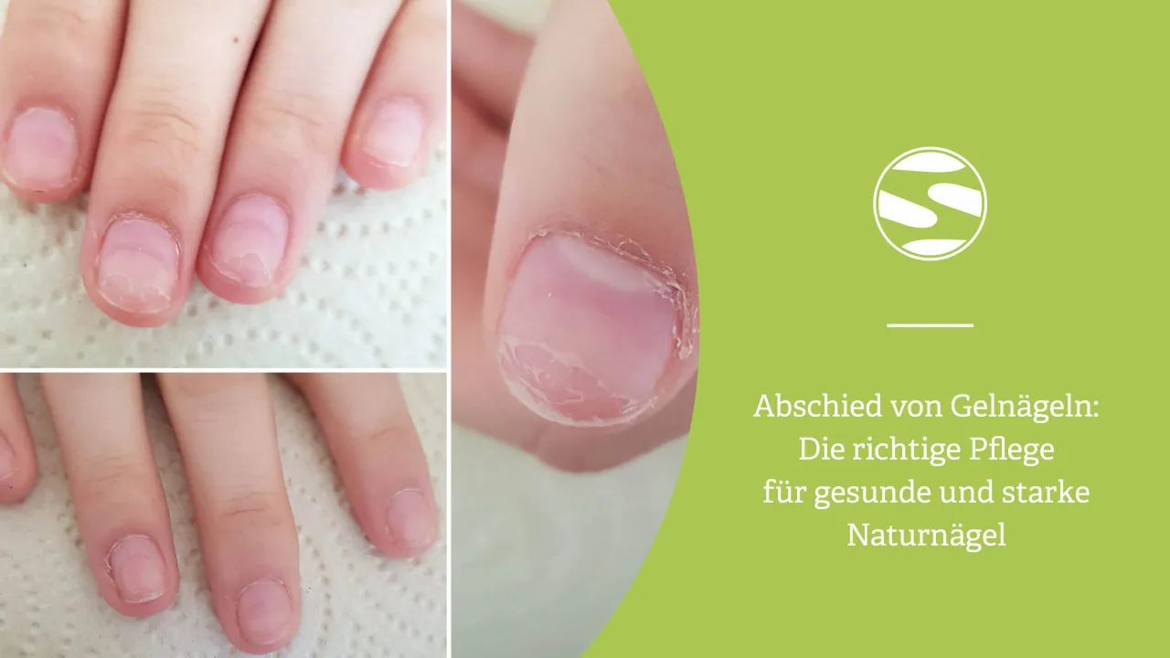 Nagelpflege nach Geln&auml;gel Entfernung