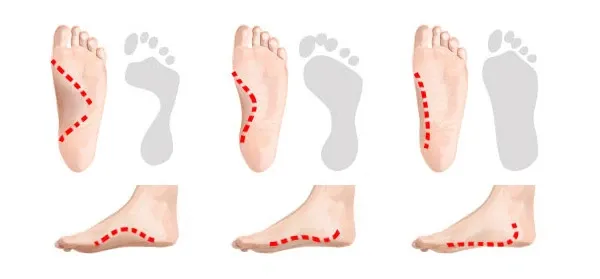 test mokrej stopy pronacja