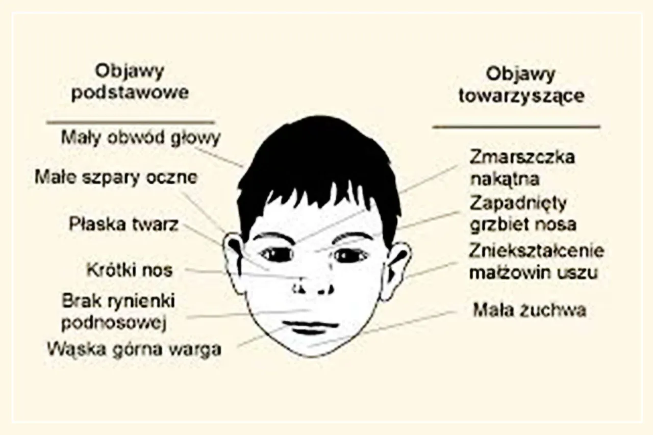 dziecko z FASD niewidzialne objawy psychiczne