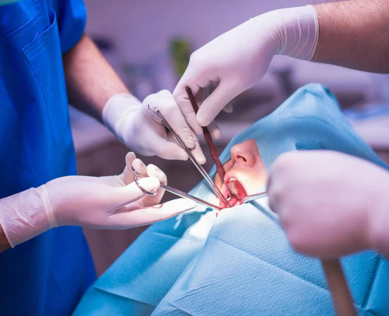 chirurg stomatologiczny usuwanie zmian