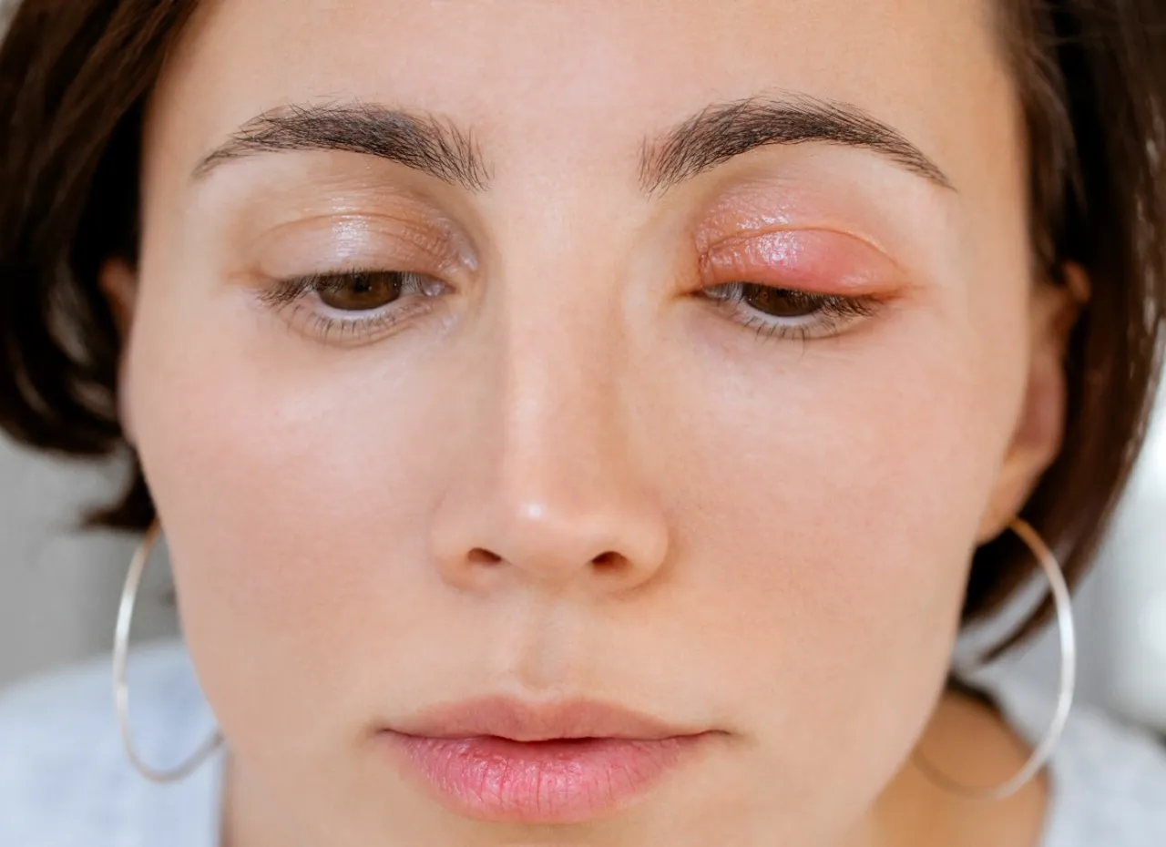 jęczmień zewnętrzny wewnętrzny r&oacute;żnice