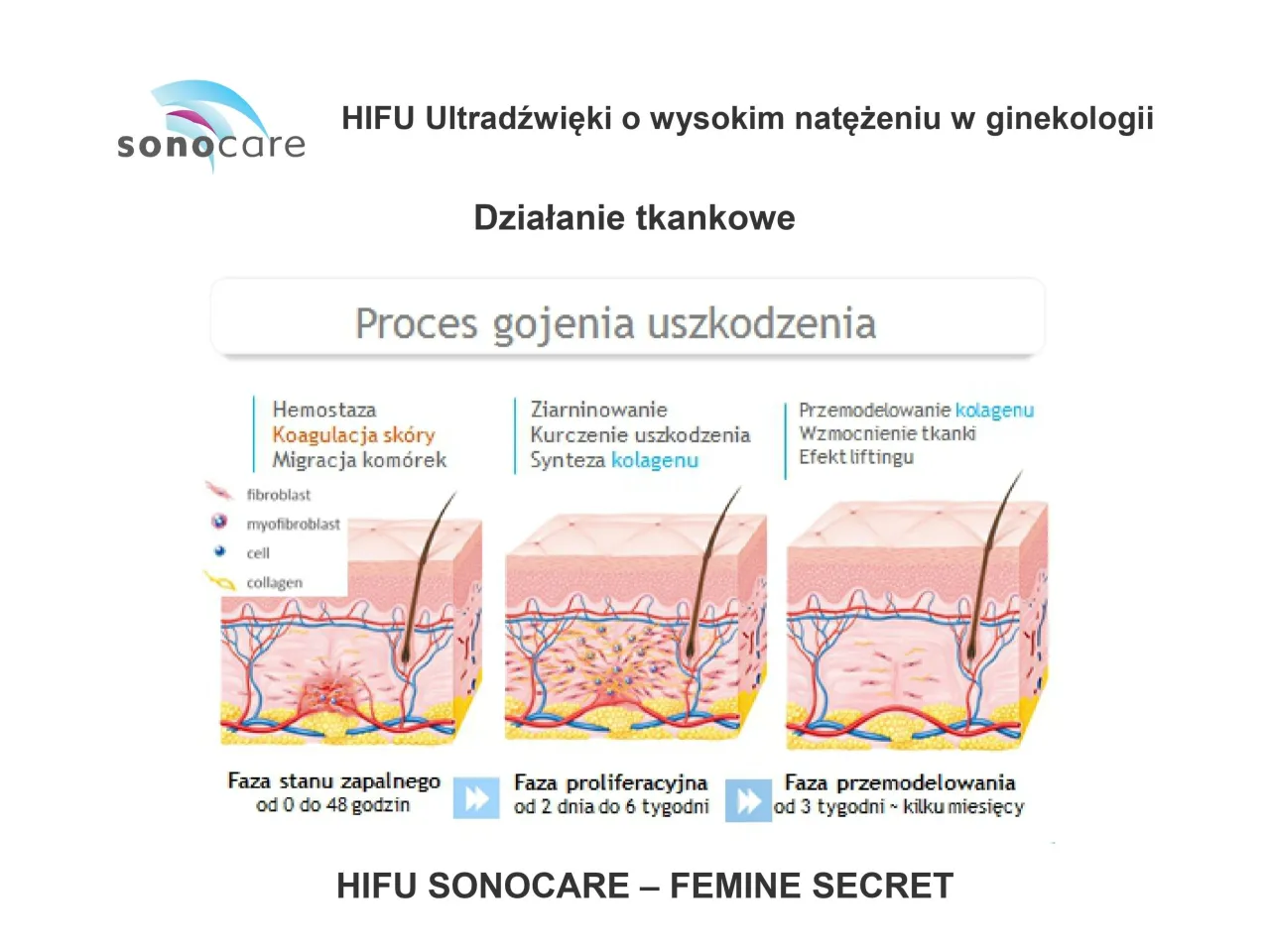 schemat działania ultradźwięków na tkanki
