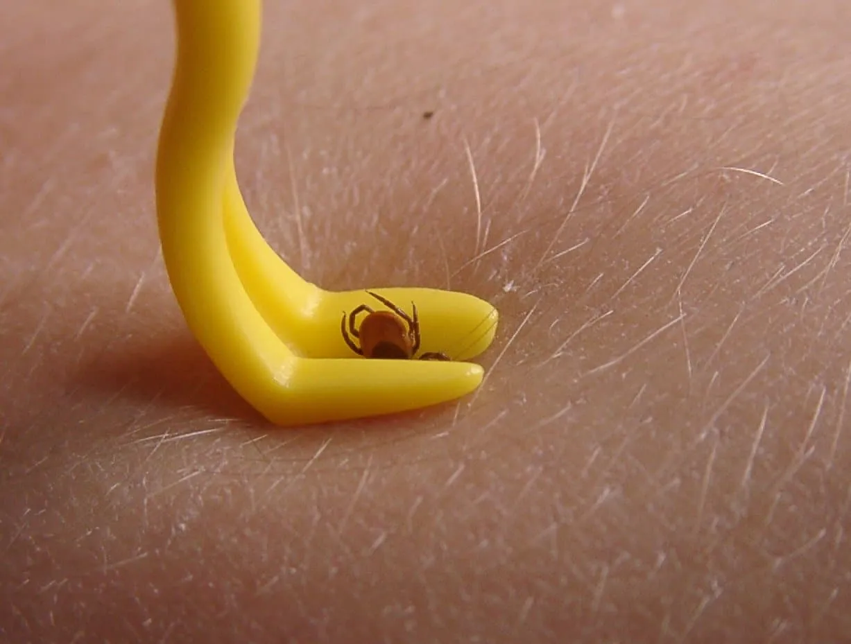 Usunięty kleszcz w pojemniku