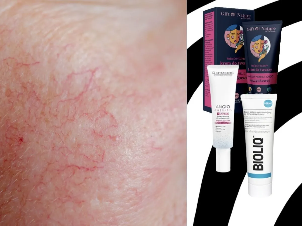 najlepsze kremy do cery naczynkowej