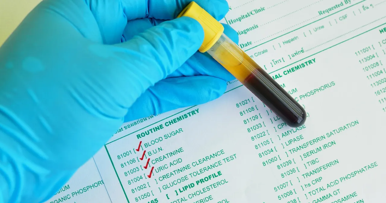 Wskazania do badania kreatyniny